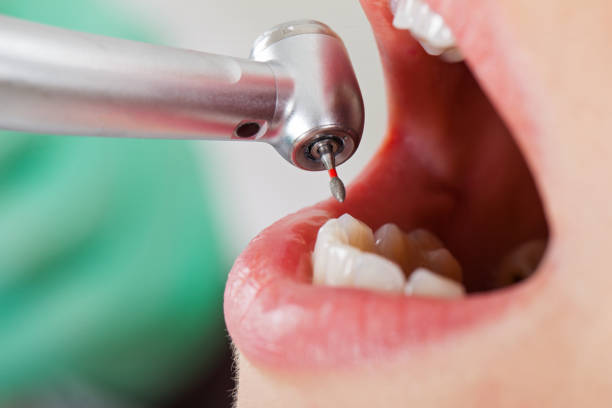 Best Emergency Treatment for Jaw Pain or Injury in Bayshe, OR